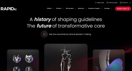 What is RapidAI? The AI software racing against the stroke
