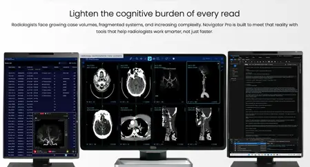 What is RapidAI? The AI software racing against the stroke