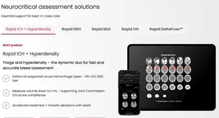What is RapidAI? The AI software racing against the stroke